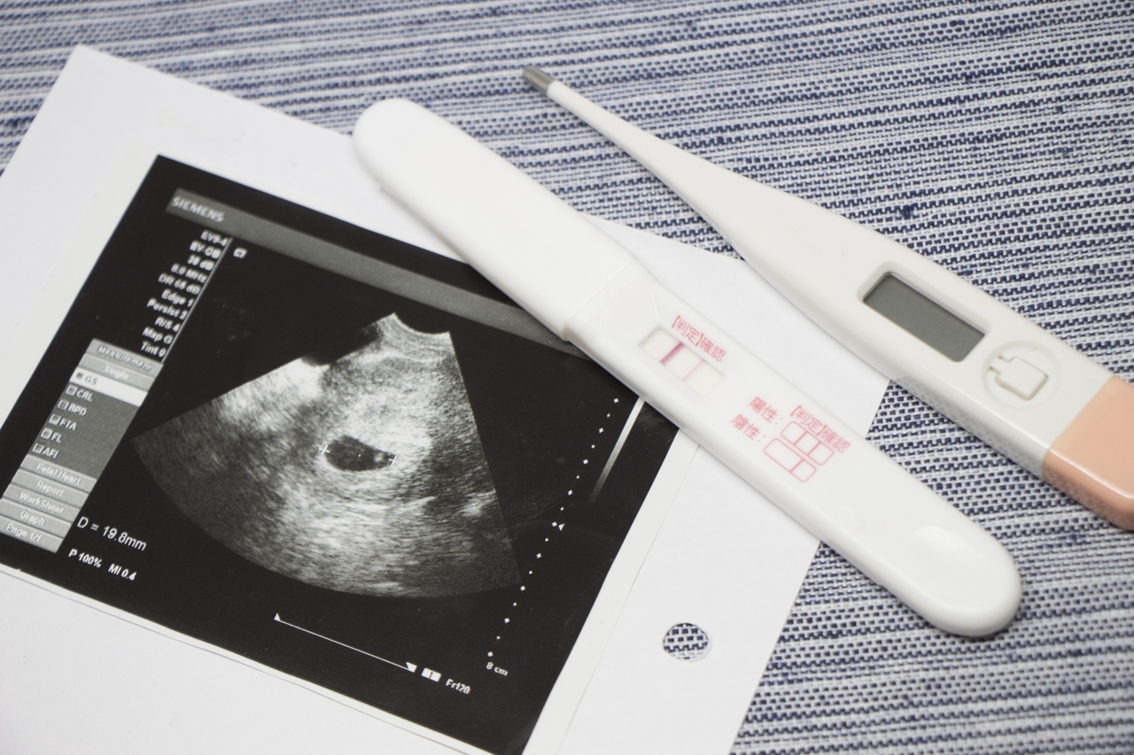 子宮外孕是什麼配圖：超音波照片和驗孕棒